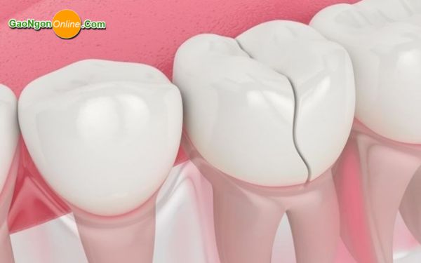 Các rủi ro đối với sức khỏe khi ăn gạo sống